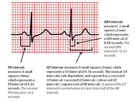 Assess for technical adequacy and presence of artifact. . What does interval resolution mean in medical terms